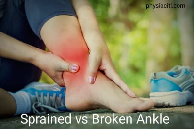 sprained ankle vs broken ankle