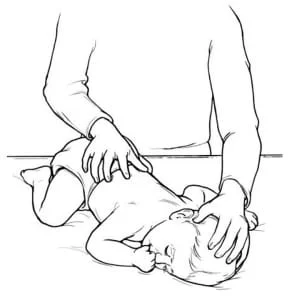 Congenital torticollis
