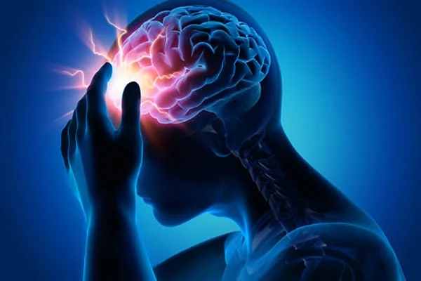 cephalgia