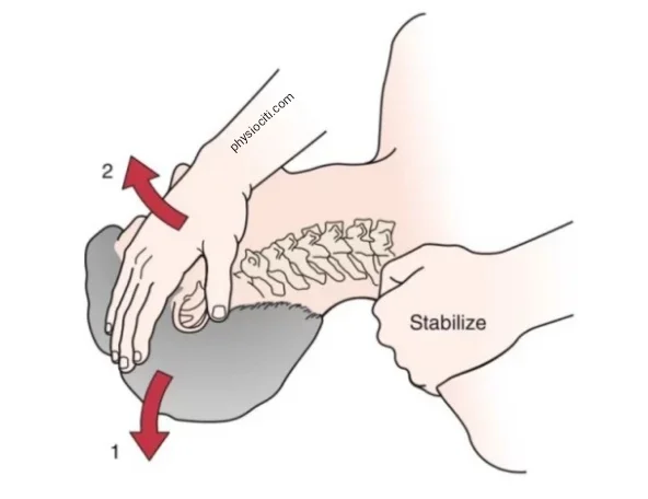 vertebrobasilar insufficiency test
(cervical quadrant)