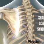 snapping scapula syndrome